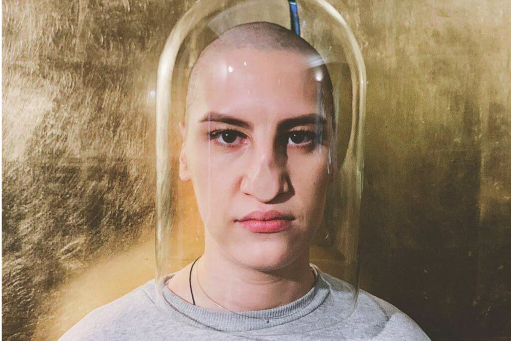 Звезда «Чик» Ирина Горбачева без бровей вызвала оторопь