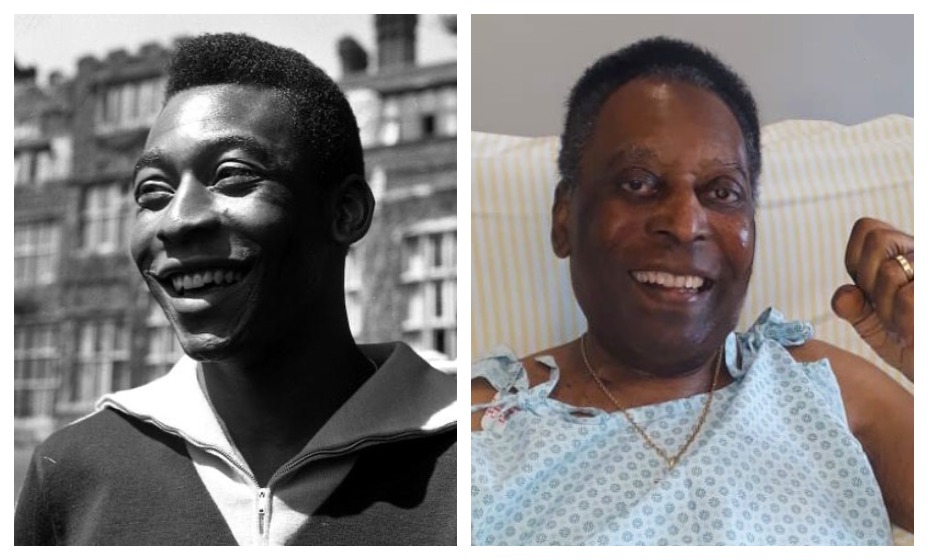 У трехкратного чемпиона мира по футболу Пеле выявили онкологию в 2021 году. Фото: Личная страница Пеле в соцсетях